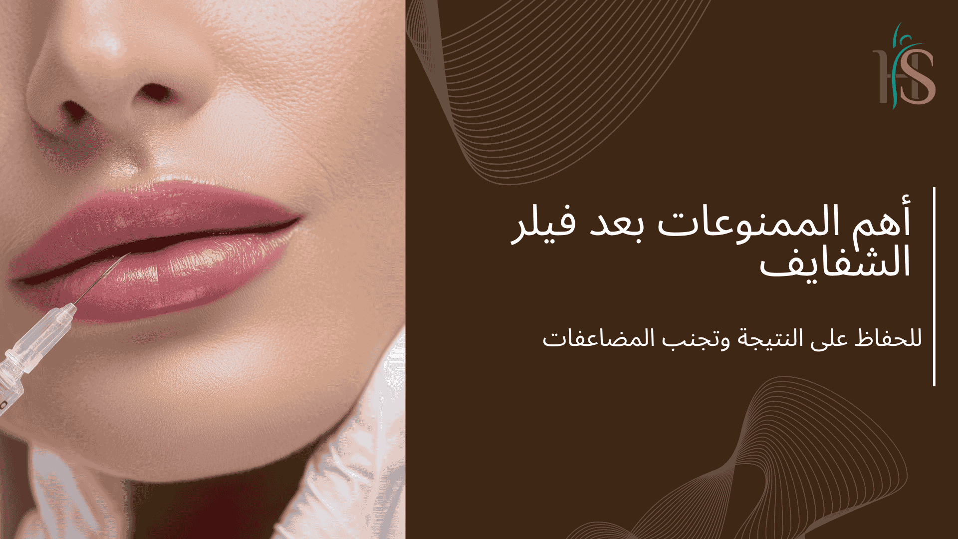 أهم الممنوعات بعد فيلر الشفايف