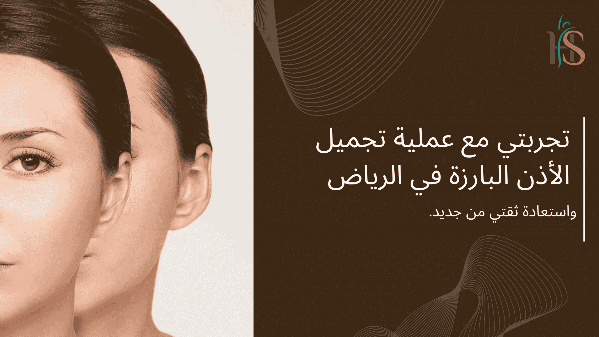 تجربتي مع عملية تجميل الأذن البارزة في الرياض