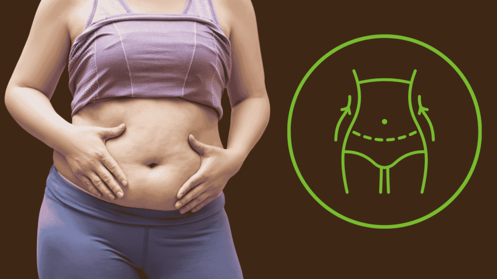 بطني منفوخ بعد عملية شد البطن مع تورم البطن بعد العملية