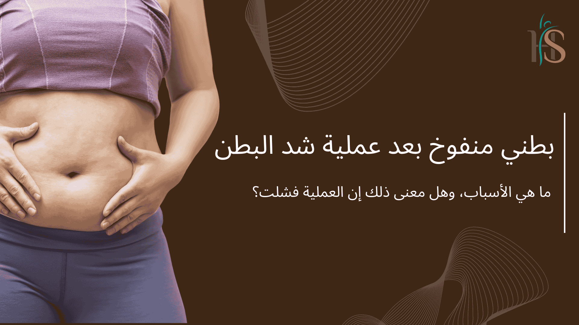 بطني منفوخ بعد عملية شد البطن