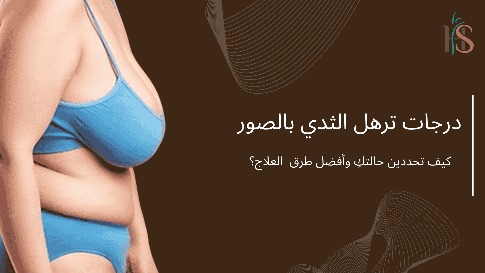 درجات ترهل الثدي بالصور | كيف تحددين حالتكِ وأفضل طرق العلاج؟