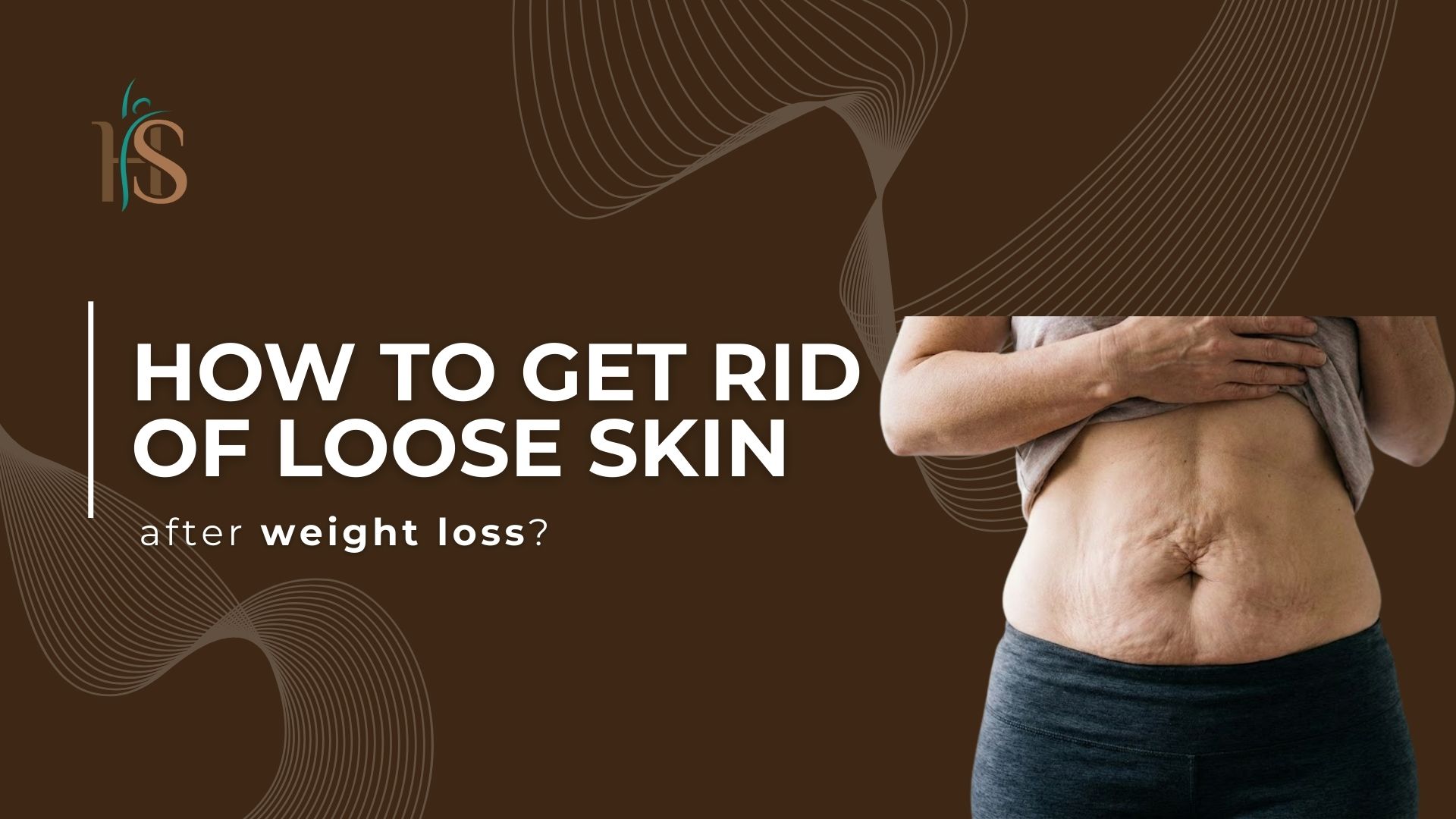 How to get rid of loose skin