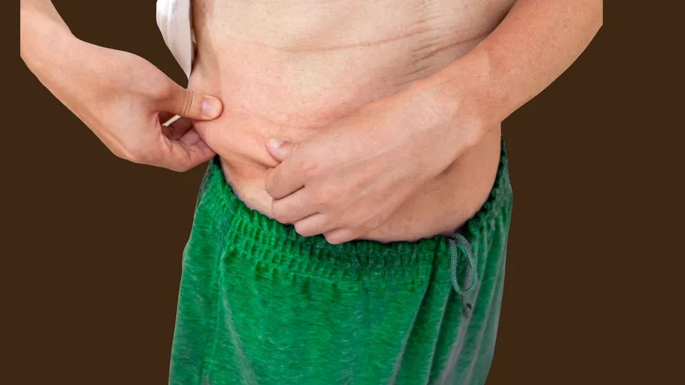 تجربتي مع الترهل بعد التكميم