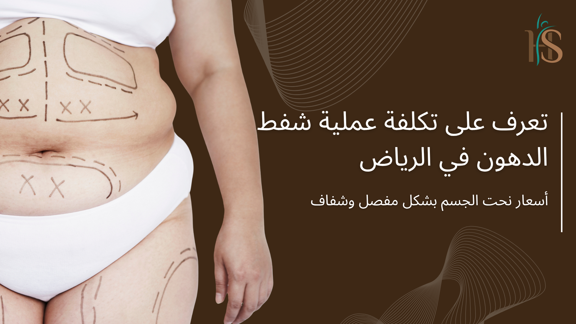 تكلفة عملية شفط الدهون في الرياض