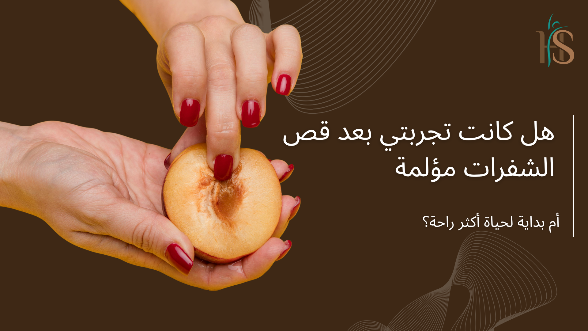 تجربتي بعد قص الشفرات