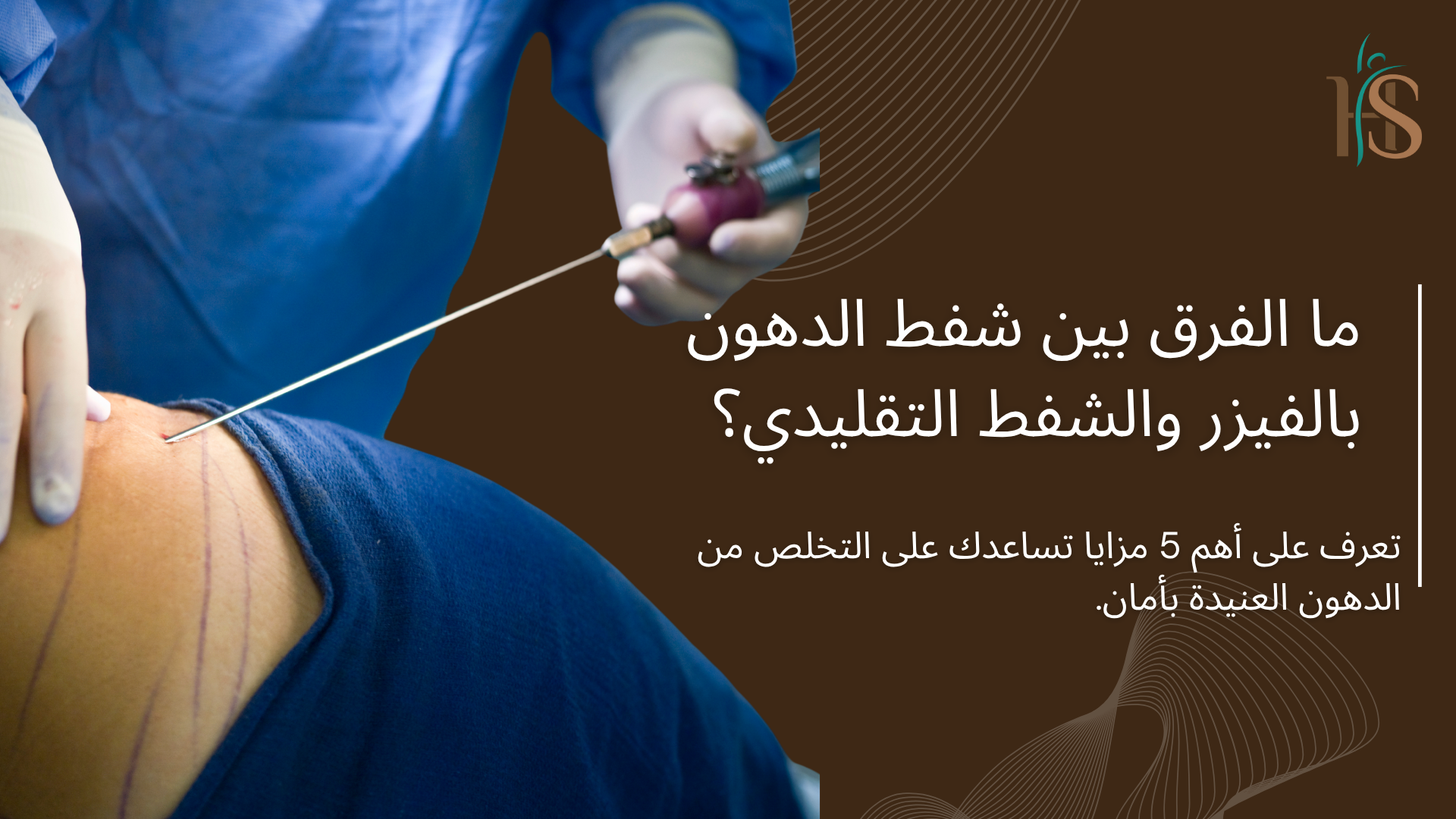 شفط الدهون بالفيزر